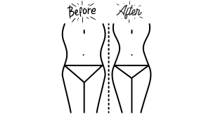 Zmyra before and after results